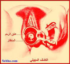 موسوعة الاجهاض بالصور