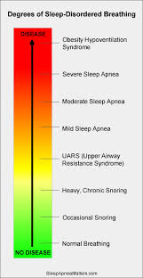 Thousands of people think it's sleep apnia or sleepapnea. Apnea Hypopnea And Rera Defined Sleep Apnea Matters