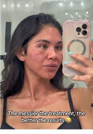 Daniele Laser and Aesthetics Leah