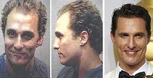 Check spelling or type a new query. 11 Celebrities Who Have Had Hair Transplants Cosmeticium