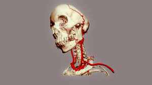 Subclavian artery , carotid artery , vertebrobasilar artery, vertebral artery and cerebral artery. Arteries Of Head Neck Download Free 3d Model By Chair Digital Anatomy Chair Digital Anatomy De9a182