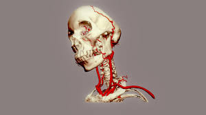 The common carotid arteries ascend into the head, via the neck, from the aorta, and delivery oxygenated blood to the brain, head, face, etc. Arteries Of Head Neck Download Free 3d Model By Chair Digital Anatomy Chair Digital Anatomy De9a182
