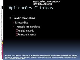 Introduction the myocarditis is an inflammatory process of the myocardial tissue, with a difficult diagnosis due the nonspecific symptoms and the lack of information from the medical Imaginologia Em Cirurgia Cardiovascular Tomografia Computadorizada E Ressonncia