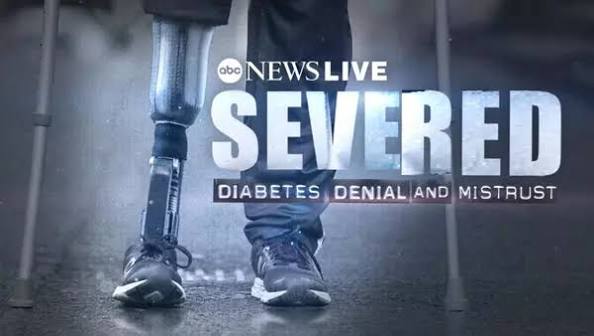 Watch Severed: Diabetes Denial and Mistrust Streaming Online | Hulu