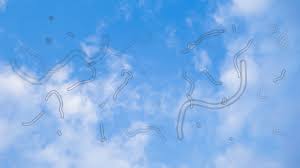 Image result for Floaters