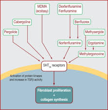 Image result for Dexfenfluramine