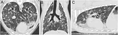 We did not find results for: Thoracic Computed Tomographic Interpretation For Clinicians To Aid In The Diagnosis Of Dogs And Cats With Respiratory Disease Sciencedirect