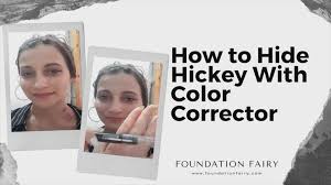 See full list on wikihow.com How To Cover Up A Hickey Without Concealer Fast 5 Minutes