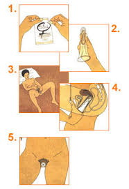 Mise en ligne rapide d'un site dynamique sans besoin de rien programmer. Preservatif Feminin Pourquoi Le Choisir Et Comment Le Mettre En Place