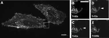 Do you think you've got what it takes to join the tough world of cryptocurrency mining? A Versatile Oblique Plane Microscope For Large Scale And High Resolution Imaging Of Subcellular Dynamics Elife