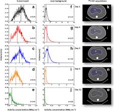 Read 8 reviews from the world's largest community for readers. Phantom Validation Of Quantitative Y 90 Pet Ct Based Dosimetry In Liver Radioembolization Ejnmmi Research Full Text