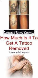 Yag laser is used in our clinic to remove unwanted tattoos.complete removal or significant fading of the tattoo colour can be achieved without. Tattoo Printer How Long Does It Take To Remove A Tattoo Is Tattoo Removal Cream Safe Tattoo Removal Near Me H Tattoo Printer Tattoo Removal Cost Laser Tattoo