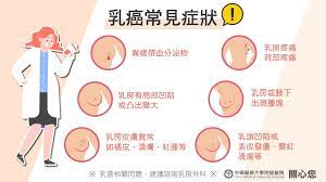 乳癌常見症狀-乳癌懶人包2 | 最新消息- 中國醫藥大學附設醫院