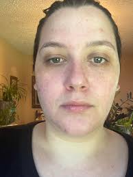 HUGE TRANSFORMATION!!! 🤌🏼✨ (Before photos in comments) Private message me  to book ladies! 🤩