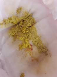 sut alerjisi kaka resmi var kadinlar kulubu