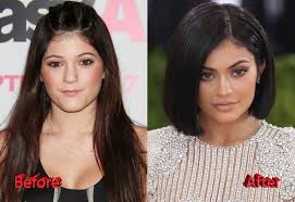 Anna is a communication expert and a life enthusiast. Kylie Jenner Plastic
