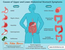 Causes Of Upper And Lower Abdominal Stomach Symptoms In 2020 Digestion Problems Digestive System Disorders Gastrointestinal Disease