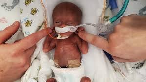 Fundraiser by Justin Isaac : Baby Lucas