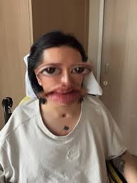 Paralysed Hong Kong Mirror dancer's medical funding thrown into jeopardy