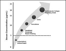 Image result for Intrapleural Anesthesia