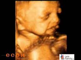 Ecografia 4d El Bebe Con 30 Semanas De Gestacion Youtube