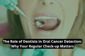 Image result for dental cancer