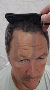 🏆Postigli smo izvanredne rezultate tokom velike promene koja je sprovedena  u dva dana. Ključna komponenta ovog uspeha je dobra procena koju može  doneti iskusni doktor. Njegovo znanje i stručnost ...