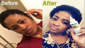 Dry, tangled and hard to manage hair will become soft, healthy and less prone to split ends and hair breakage. Big Chop Hair Journey Wild Growth Oil Before After Youtube