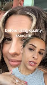 Things that have transformed my skin over the past 2 years: 🌱ANTIAGING  PRODUCTS: