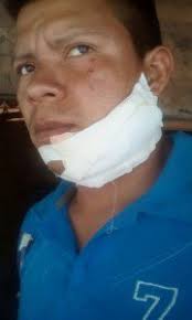 Freedom & Fairness for Fyffes Workers