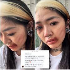 Cái này là sao vậy anh em Người trong ảnh là nyc Blacka