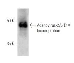 Image result for svrab na k%u016F%u017Ei