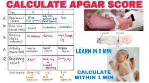 Image result for APGAR Score
