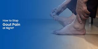 Image result for gout symptoms knee