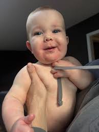 Went to the allergist today. She confirmed he is allergic to egg and  peanuts. said since the egg is mild to only expose it to him in baked goods  and he should