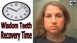 Swelling after wisdom tooth extraction: Wisdom Teeth Removal Swelling Day 4 Teethwalls