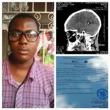 mwen se francois smith Junior map soufri ak yon tumer nan sèvo ,mw pa pa  gen mwayen poum al fè operasyon an cuba tanpri edem al fè operasyon an,yeux  mwen yo komanse