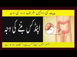Pin On Bimari Ki Alamat Aur Waja