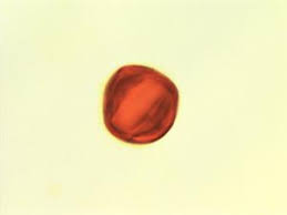 Image result for Melastomastrum segregatum