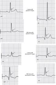 Image result for J Wave