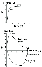 A Volume Time And B Flow Volume Curves In The Flow Type