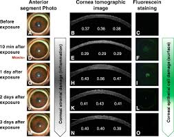 Pir project for engineering students. Ocular Effects Of Exposure To 40 75 And 95 Ghz Millimeter Waves Springerlink