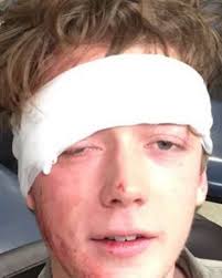 Live session of “Black & Blue” out today 🤕 Swipe for a photo my friends  have long called “Jack & Blue” (pc: @tyler__squires ). Thanks for almost 5  years of listening! Can't