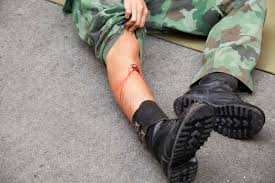 A gunshot wound (gsw) is physical trauma caused by a scattershot or a bullet from a firearm. 2 223 Gunshot Photos Free Royalty Free Stock Photos From Dreamstime
