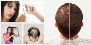 The skin diseases of scalp can lead to hair loss due to excessive itching or excessive acrid discharges from the lesions. Power Pills Homeopathy