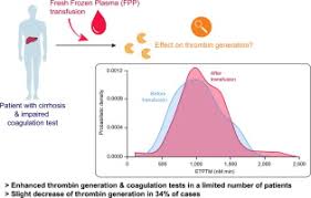 Image result for Plasma Transfusion