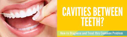 Eventually, pain and discomfort can begin if the cavity gets large and close. Cavities Between Teeth How To Diagnose Treat This Problem