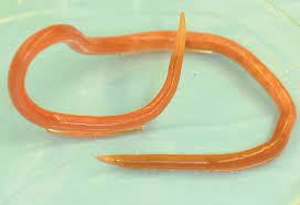 There are actually a number of ways for us to remove waste from our body. Young Man Who Passed A Worm Consultant360