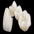 Zirconia crown product image