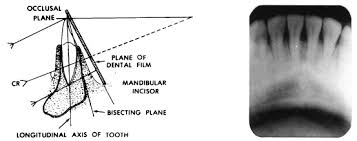 Dental Radiography